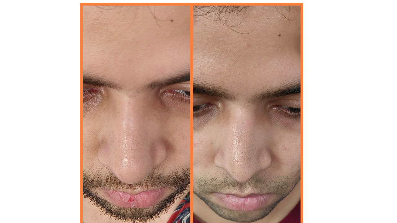 Suvarna Talk Photo 12